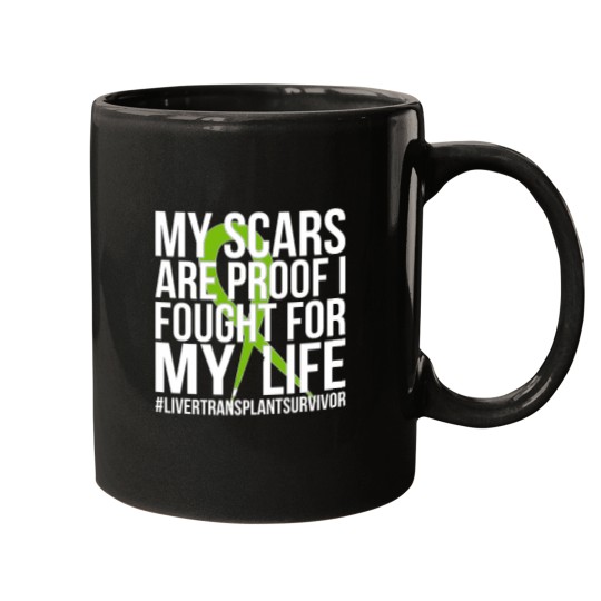 Discover Liver Transplant Survivor Liver Transplant Surgery Mugs