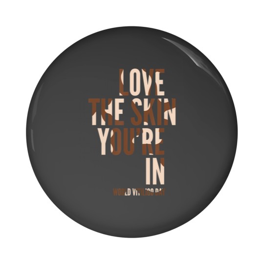 Discover love the skin you're in, vitiligo awareness Pin Buttons